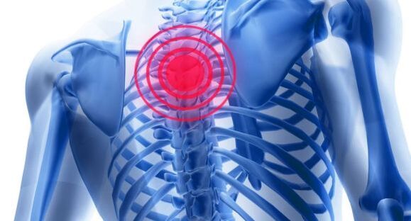 Behandlung der Osteochondrose der Brustsäule